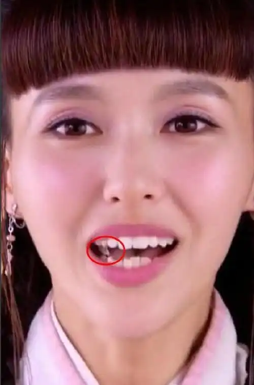 整牙如换脸原来唐嫣也有这么无法入眼的时期