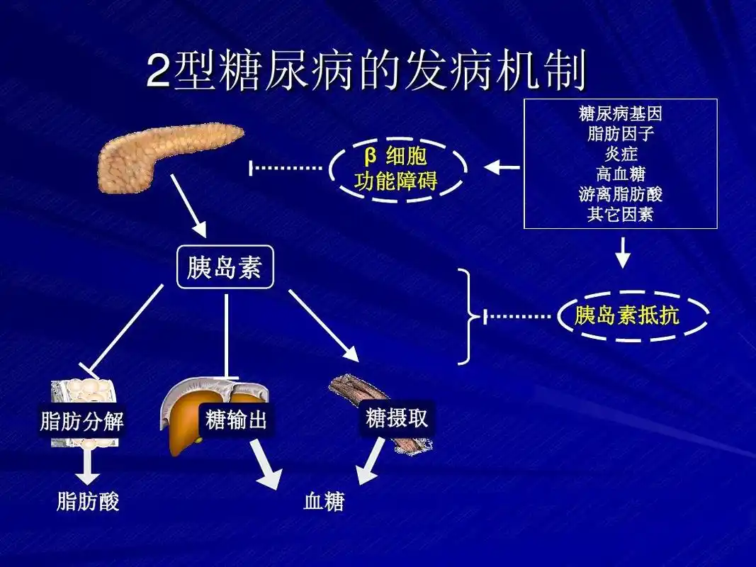 方便,实用,中西医结合 2型糖尿病的发病机制 β 细胞 功能障碍 糖尿病
