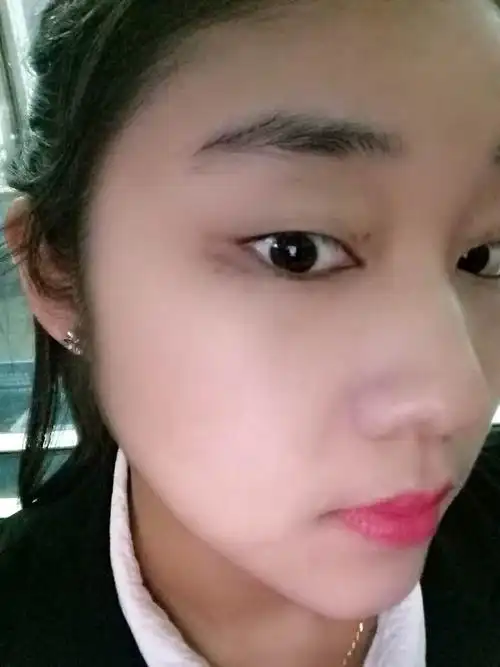 眼角黑是怎么回事   _微赞云社区_微赞