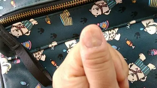 每个指甲都好的但是月牙小的很,只 30 从小就大拇指中间有道凹陷,不