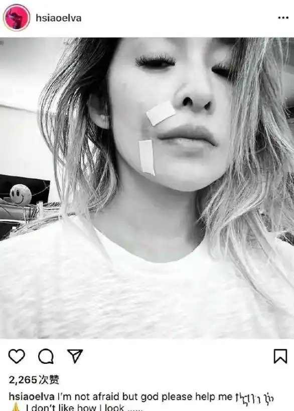 面黄肌瘦,43岁萧亚轩近况直播爆出,网友:她怎么变成这样了?