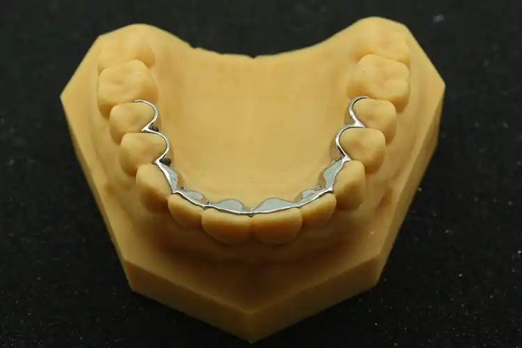 3d打印舌侧保持器-矫正器-云南家红齿科技术股份有限公司