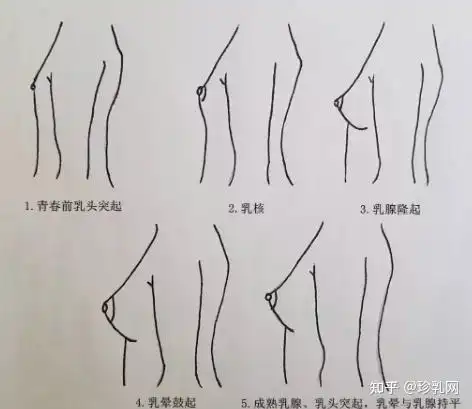 917岁的女孩乳房是怎样发育的专家解读