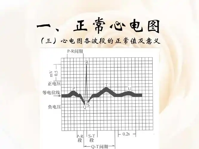 心电图基础知识ppt