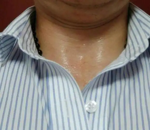 就是无论做什么都容易大汗淋漓,身上会变得黏黏的,会让人心情大减.