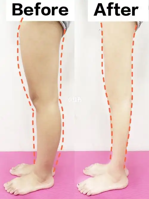 大腿前凸显腿粗显腿短71试试这个75