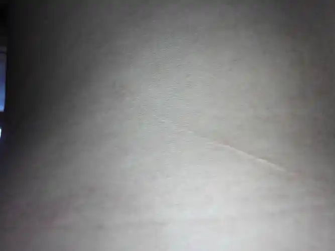 问:请问专家,这个背部伤疤是一般刮痕还是手术伤痕?