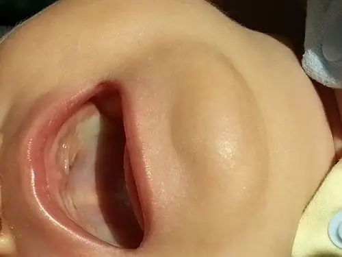 详见图片,谢谢!