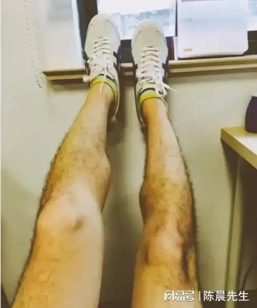 包皮|腿毛|胸毛_网易订阅