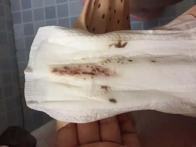 例假【多图】_39医疗图集-39健康网