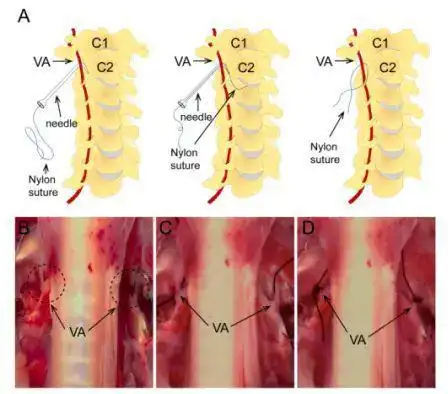 四血管阻断法大鼠脑缺血再灌注模型建立4vo小鼠脑缺血模型构建