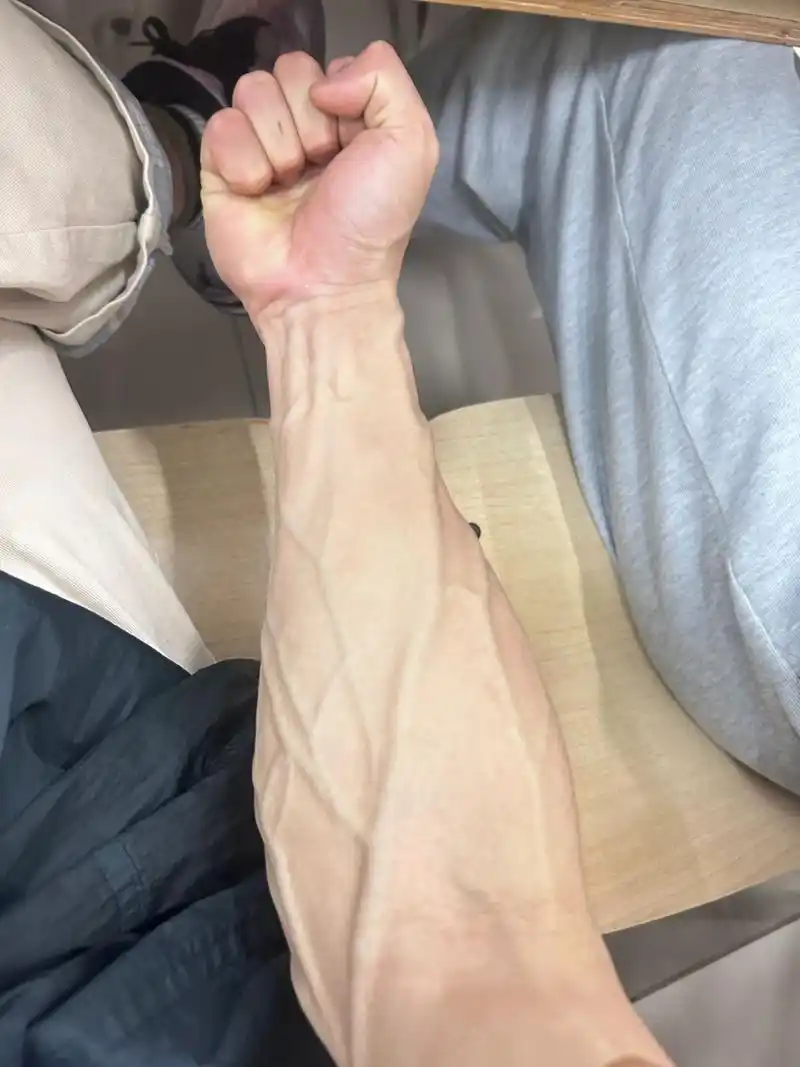 这大概是护士最喜欢的胳膊了,打针的时候容易找血管[左捂脸]