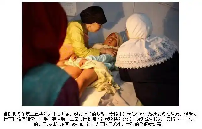 残酷的穆斯林割礼