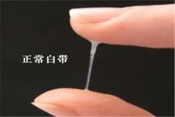 女性内裤发黄是正常现象吗