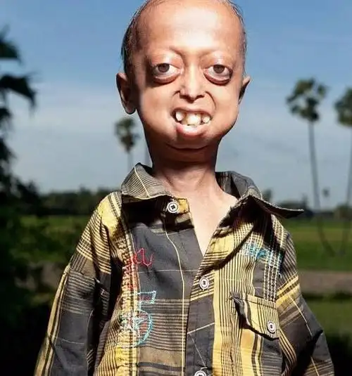 印度夫妻生下的5个孩子,全都是畸形人,医生:真是无知!