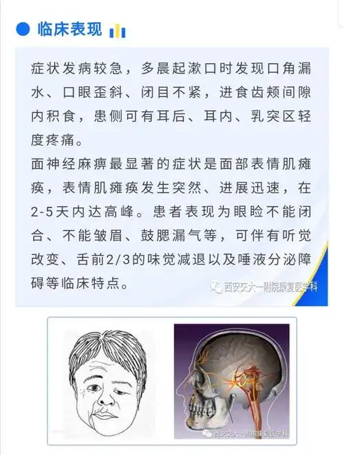 面瘫的康复治疗_面瘫_日常注意事项_康复锻炼 - 好大夫在线