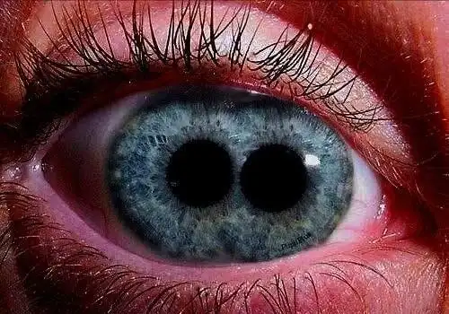 中国历史上有许多"重瞳"的记载,也有人说这是p图的,世界上根本没有