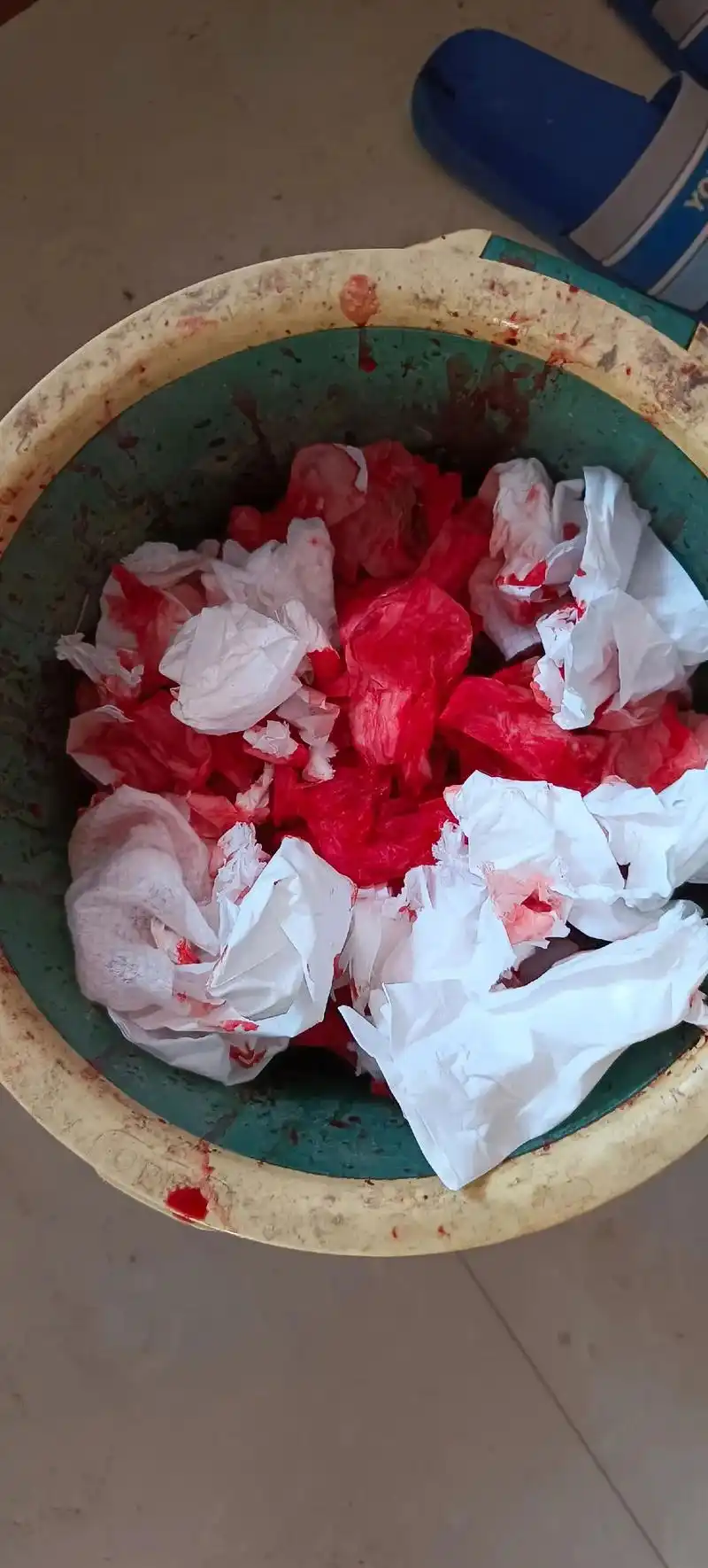 真是要了我的命了,成夜成夜的不敢睡,害怕孩子夜里发烧