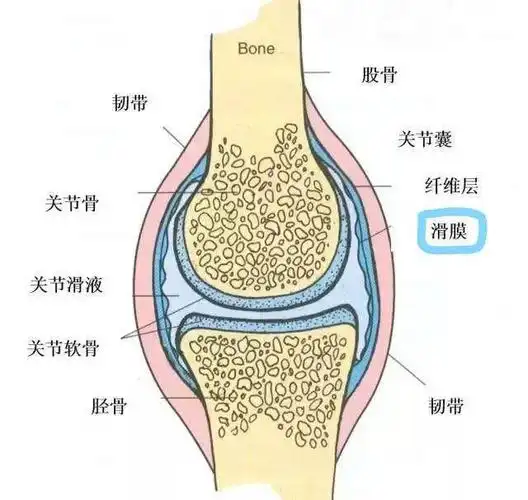 膝关节滑膜示意图 pvns 分型