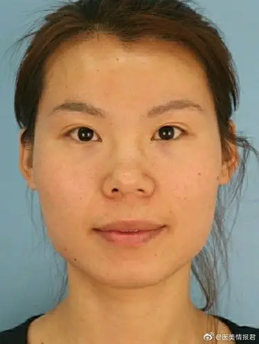 如何拯救大脸扁平脸颧骨高脸型