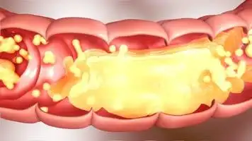 清除肠油人体肠道肠胃清理益生菌益生视频素材