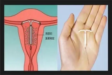 大姨妈几天才能同房 来月经可以做房事吗