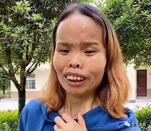 赣州女子一丑成名靠奇特长相圈粉百万自信程度不输凤姐