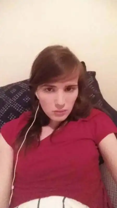 男变女手术恢复照片男人变女人变性手术前后对比图片5