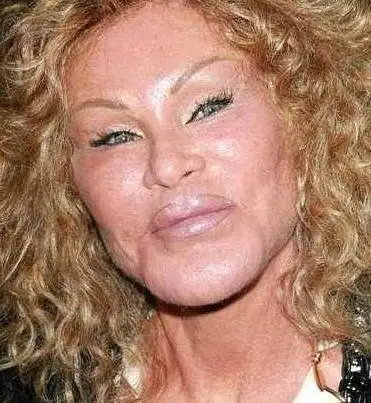 但越整越丑还被老公强制性的离婚,离婚后这我富婆原本以为男人都会