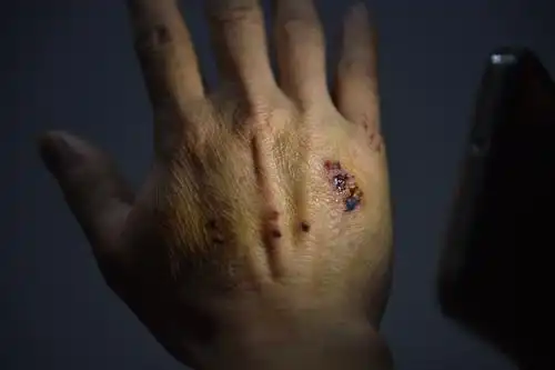 福州一男子牵狼狗进国艺花鸟市场 一商户被咬伤