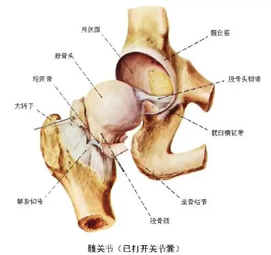缺血性股骨头坏死