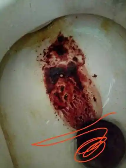 大姨妈流的血是这样的为什么