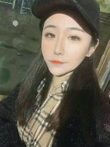 自体脂肪填充全脸 下至 开外眼角术后秒变18的小姑娘_眼睛