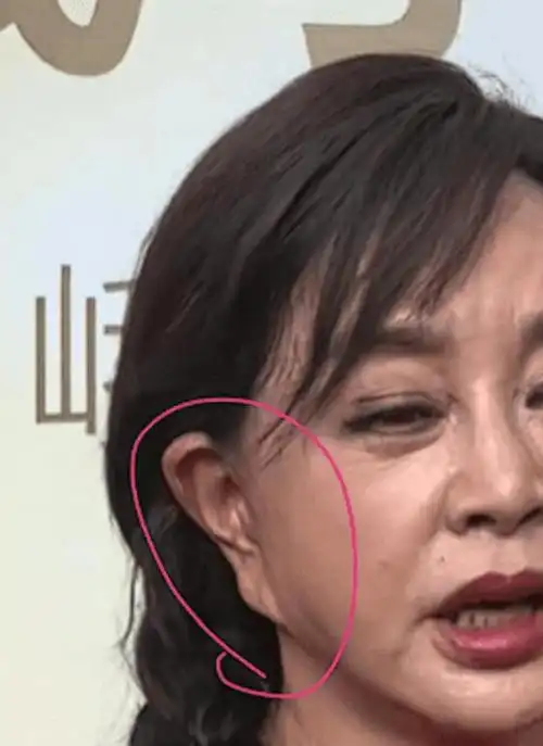 73岁刘晓庆罕露面,真实镜头下脸垮起褶子,网友:自然老去不好吗