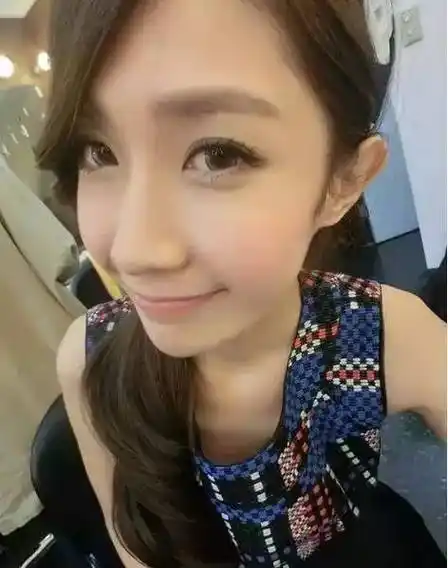 网红脸看起来更温柔,尖酸刻薄拜拜了——玻尿酸填充太阳穴