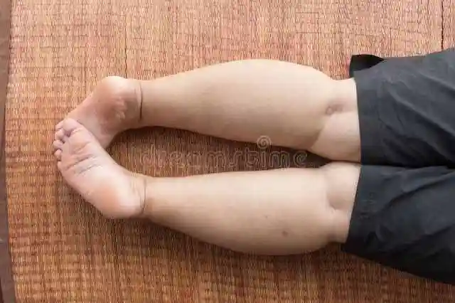 小腿内侧腓肠肌怎么减小腿腓肠肌发达该怎么瘦