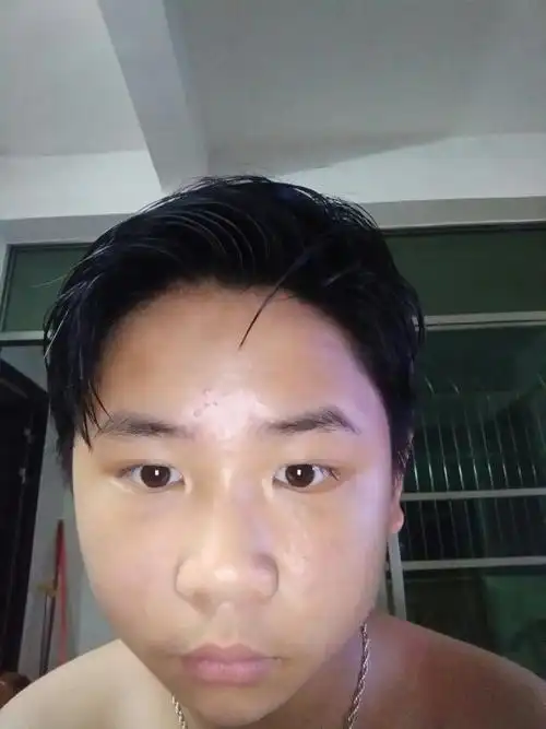 为什么眼睛一个大一个小,以前是一样的,不知道为什么,最近这样了,和