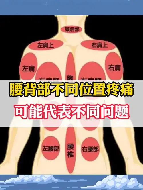 腰背部不同位置疼痛可能代表不同问题