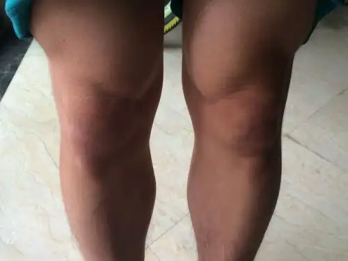 说来我有个问题,今天跑步无意间发现我的大腿那两块突出来的肉是咋