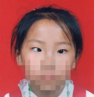 昨天,一些家长在何琪医生的中医治疗儿童斜视弱视微信交流群中埋怨,在