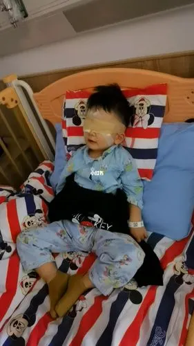 手术 还是很可怜的 手上还要打留置针 心疼开好之后两只眼睛包着还在