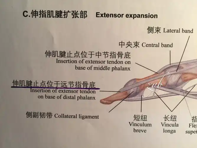 上图解剖:指伸肌腱末节指骨止点(侧束).