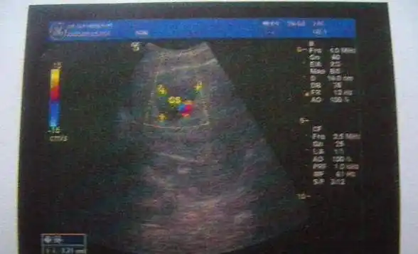 b超单信息含量大,这几个重要信息,关乎胎儿健康,你会看吗?