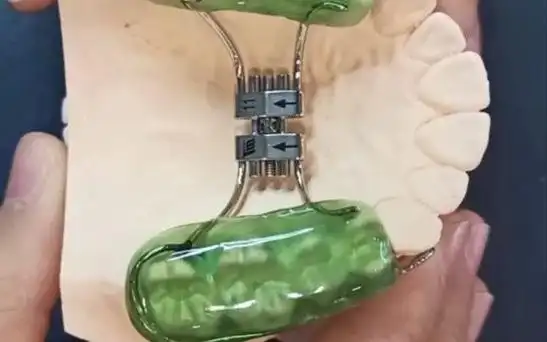 前方牵引矫治器的功能和用法