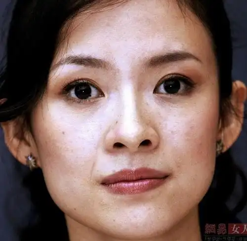 清流,舒淇做过激光祛斑吗