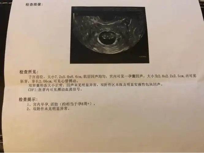 8周 这个孕囊是不是很圆?