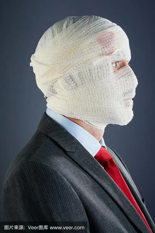 商人,头部裹着绷带,完全被遮住了