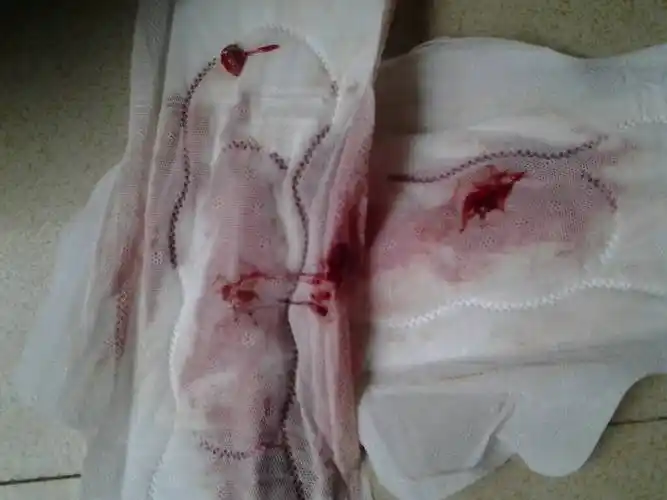 不好意思,我不要怪我恶心.我真想问问我这是怎么了?来的月经怎么这样,