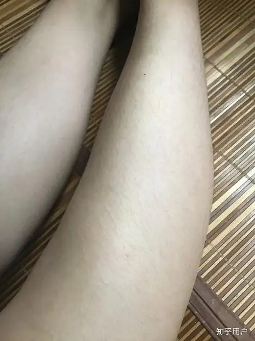 女生腿毛旺盛是怎样的人生体验