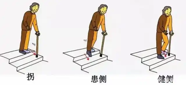 脑中风偏瘫患者,走路划圈步态怎么办?这7个简单的动作教你纠正